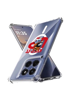 Husa Antisoc pentru Motorola Edge 60 / Edge 60 Fusion - AirBag TPU, Colțuri Ranforsate - Keep It UP
